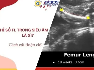 Fl trong chứng khoán là gì "Sàn" hay "Trần"? Phân tích góc khuất gây thua lỗ