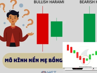 Nến Mẹ Bồng Con Bí Ẩn Giải Mã Thị Trường Tài Chính Năm 2026